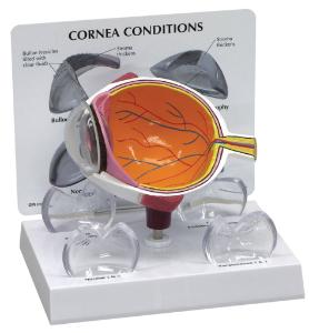 GPI Anatomicals® Cornea Eye