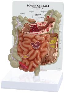 GPI Anatomicals® Gi Tact Model