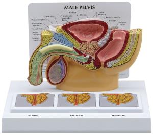 GPI Anatomicals® Male Pelvis with 3D Prostate Frame Model