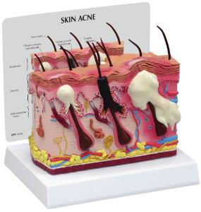 GPI Anatomicals® Skin Normal/Acne Model