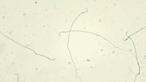 Sperm, rat slide