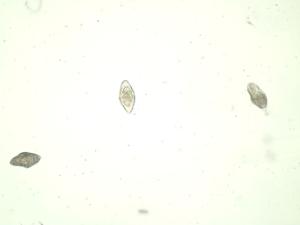 <i>Schistosoma haematobium</i>, Eggs Slide