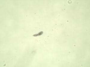 Schistosoma manson, Miracidia Slide