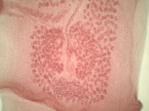 <i>Taenia pisiformis</i>, Mature/Gravid Proglottids Slide