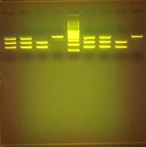 MINIPCR sickle cell genetics lab