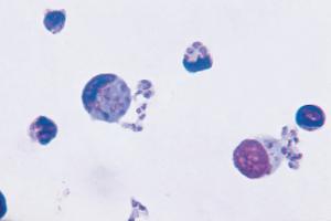 Toxoplasma gondii Slide