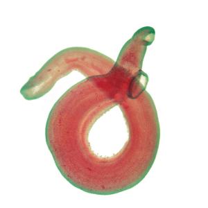 <i>Schistosoma haematobium</i>, Male Slide