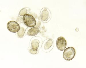 <i>Schistosoma japonicum,</i> Eggs Slide