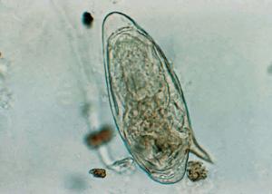 <i>Schistosoma mansoni</i>, Eggs Slide