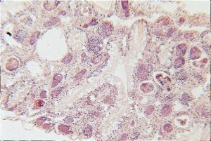 Schistosoma mansoni, Secondary Sporocysts, section, hematoxylin and triosin stained slides