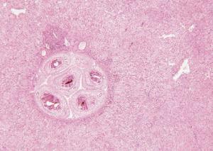 Schistosoma mansoni, Adults and Eggs Slide