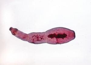 <i>Echinococcus granulosus</i> Slide