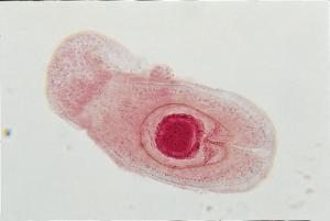 <i>Hymenolepis sp.</i>, Cysticercoid Slide