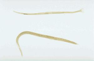 <B><i>Ancylostoma sp</i>.</B>, Male/Female, Slide