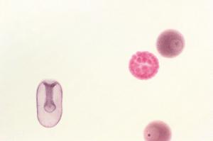 Starfish embryology I, composite