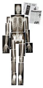 Full Scale Human X-Rays