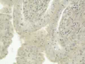 Toxoplasma gondii, Small Intestine Slide