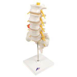 Lumbar Spinal Column