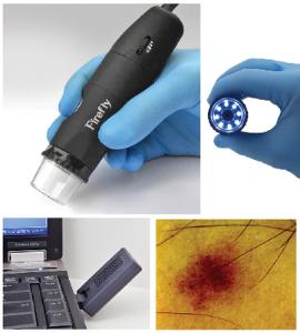 Firefly Digital Video Dermatoscope