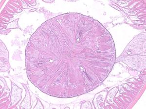 Ascaris lumbricoides- Esophagus Triradiate Lumen