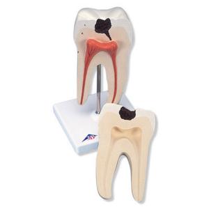 3B Scientific® Classic Tooth Models