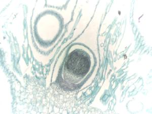 <i>Marchantia</i>, Young Sporophyte Slide