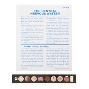 The Central Nervous System Microslide