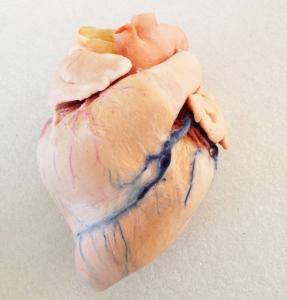 Plastinated Pig Heart