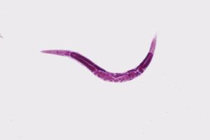 Ward's® Live <i>Caenorhabditis elegans</i>. culture
