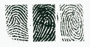 Ward's® Fingerprint Types Slide Set