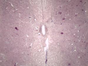 Spinal Cord with Ganglion Slide