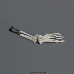 BoneClones® Ankle Sprain Model