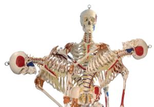 Rudiger® Flexible Ligamentary Skeleton