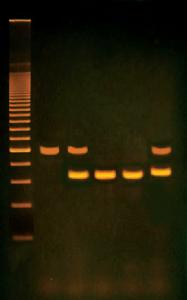 PCR Based Alu Human DNA Typing