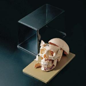 Somso® Advanced Demonstration Skull