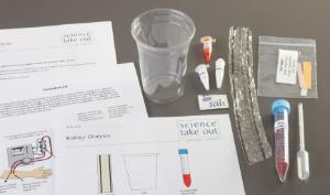 Science Take-Out® Kidney Dialysis