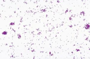 <i>Agrobacterium tumefaciens</i> smear, Gram (-) Slides