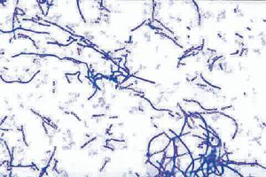 Bacillus anthracis, Gram (+) Slide