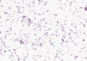 Streptococcus pneumoniae Slide