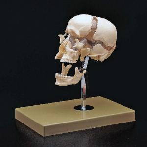 Somso® Beauchene Skull