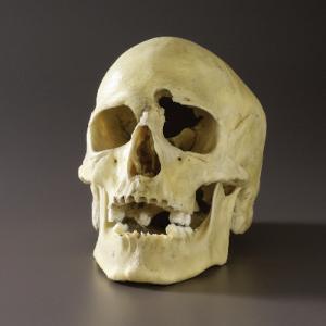 Plastic Skull with Gunshot Wound