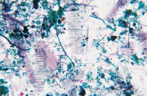 Mixed Diatoms Slide
