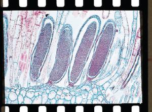 Mnium, Antheridia mediolateral section, quadruple stained slides