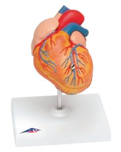 3B Scientific® Heart With Left Ventricular Hypertrophy (LVH)