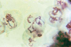 Lily Meiosis, First Meiotic Division Slide