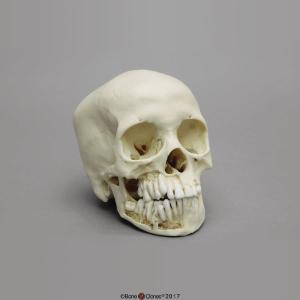 Human Child Skull 12-year-old, Dentition Exposed