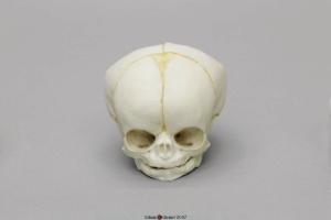 Human Fetal Skull 35 Weeks