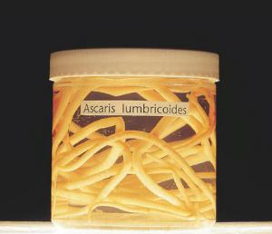 Preserved Ascaris lumbricoides