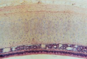 Hyaline Cartilage, Mammal, Trachea