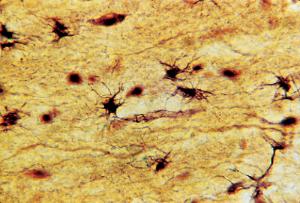 Neuroglia, Fibrous Astrocytes Slide